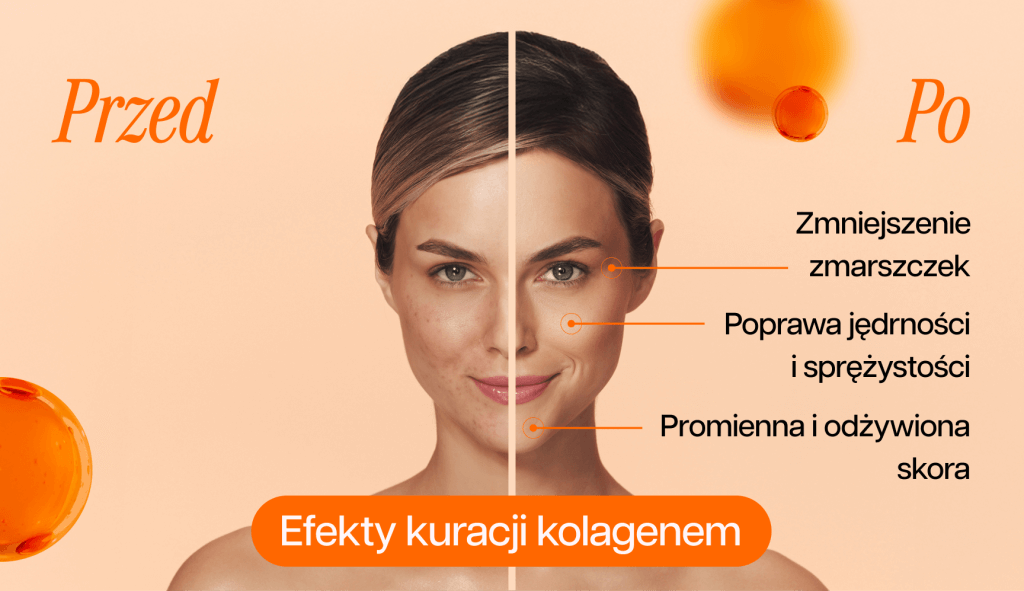 grafika przedstawiająca efekty kuracji kolagenem
