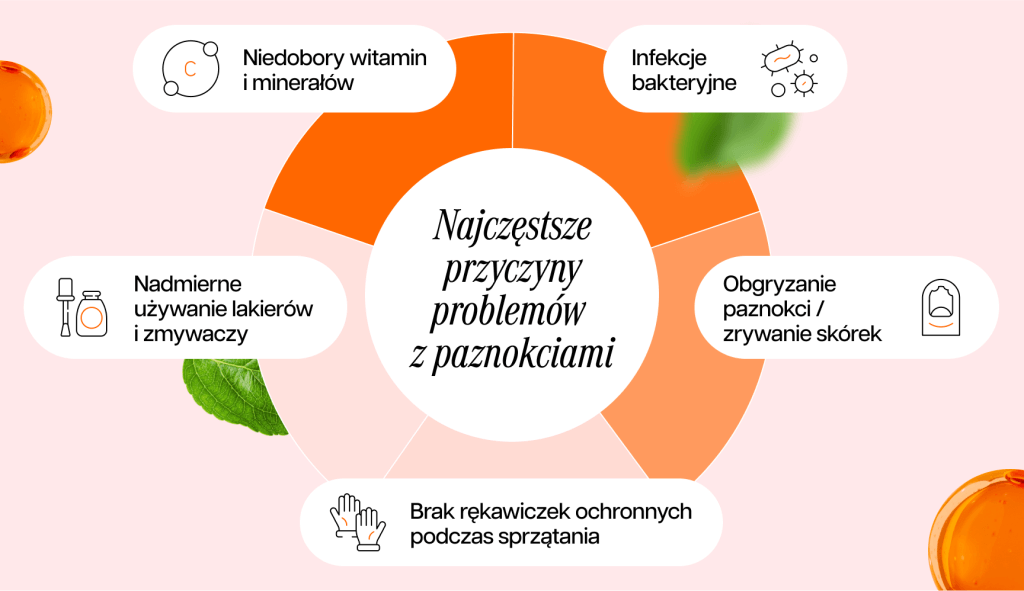infografika przedstawiająca najczęstsze przyczyny problemów z paznokciami