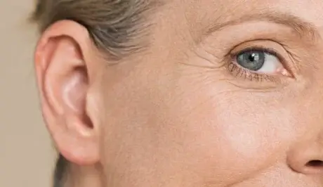 zmarszczki wokół oczu