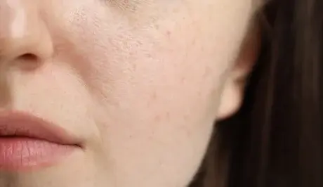 dlaczego skóra szybciej starzeje się w mieście