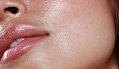 dlaczego Twoja skóra może tracić blask